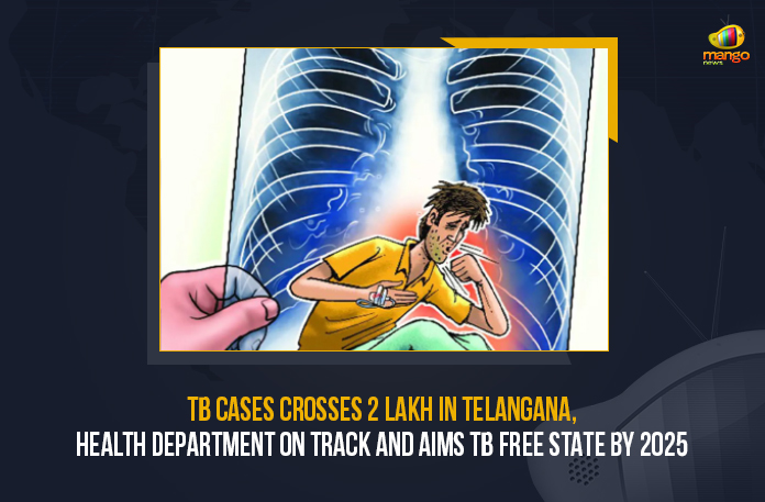 TB Cases Crosses 2 Lakh In Telangana Health Department On Track And Aims TB Free State By 2025, TB Cases Crosses 2 Lakh In Telangana, Telangana Health Department On Track And Aims TB Free State By 2025, TB Free Telangana State By 2025, 2 Lakh TB Cases In Telangana, Telangana Health Department, TB Cases, Tuberculosis Cases increased, Tuberculosis Cases increased In Telangana State, Tuberculosis Cases In Telangana, Tuberculosis Cases In Telangana Latest News, Tuberculosis Cases In Telangana Latest Updates, Tuberculosis Cases In Telangana Live Updates, Mango News,