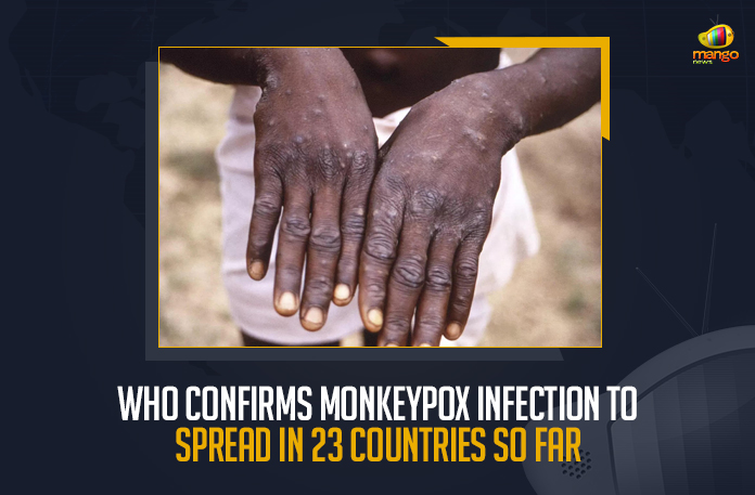 WHO Confirms Monkeypox Infection To Spread In 23 Countries So Far